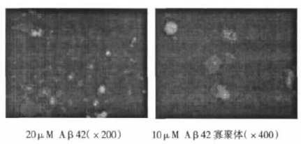 TUNEL 法测定细胞凋亡的荧光显微镜照片